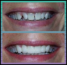 Bradlee Dental Care - dull, misshapen teeth
