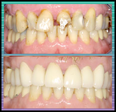 Bradlee Dental Care - laser dentistry