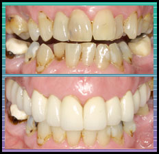Bradlee Dental Care - laser dentistry